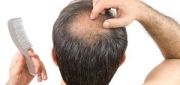 Men's Hair Loss Treatments