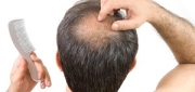 Men's Hair Loss Remedies