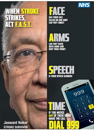 Stroke Act F.A.S.T.